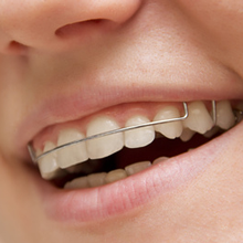 小金ファミリア歯科では月1回矯正治療を行っています
